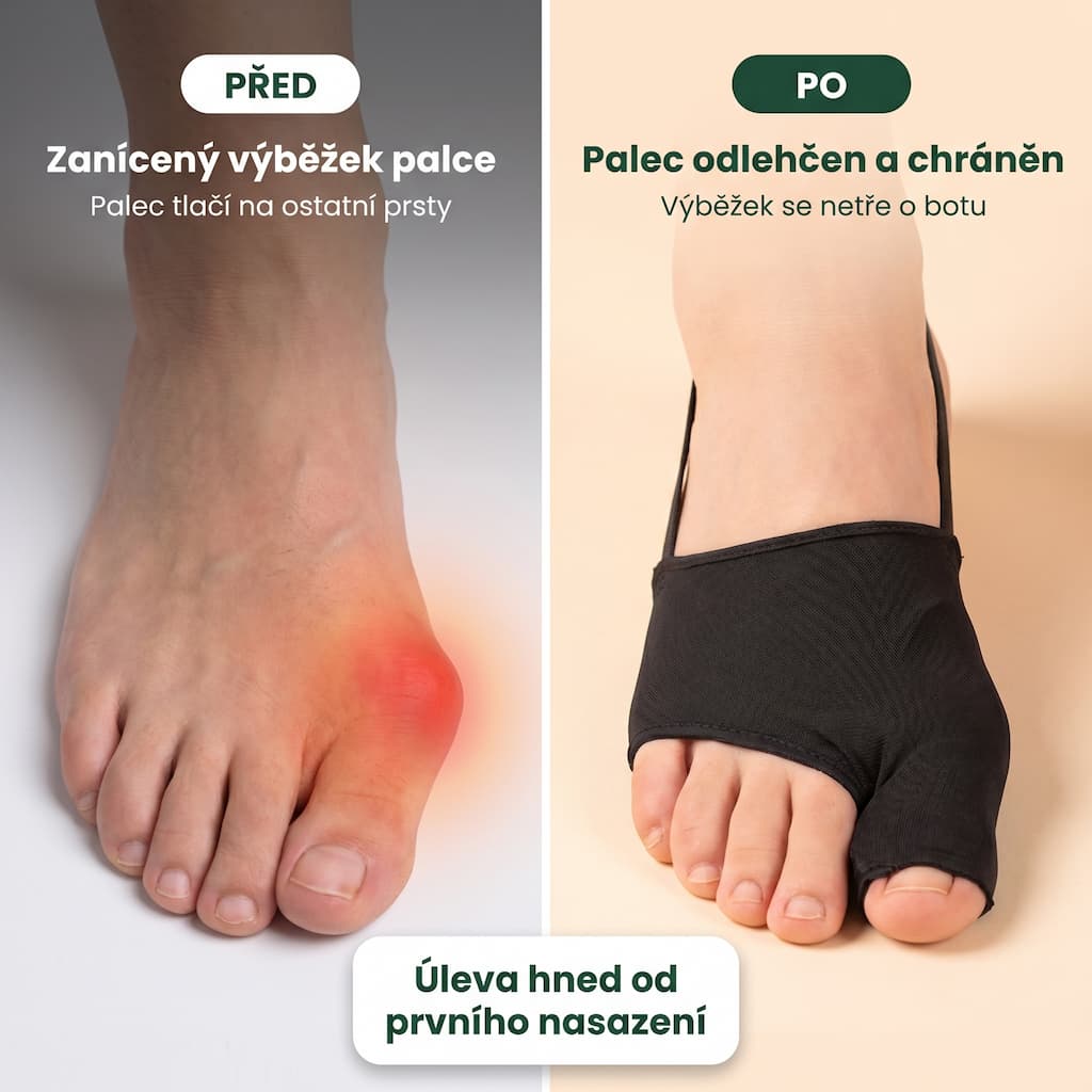 Předřezané tejpy na hallux valgus, černé, 10 ks v balení